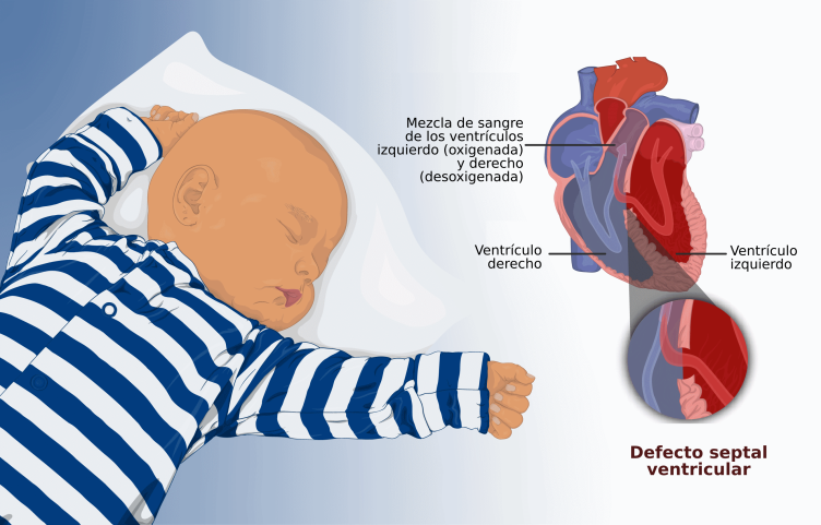 Diferencia entre ventrículo izquierdo y ventrículo derecho